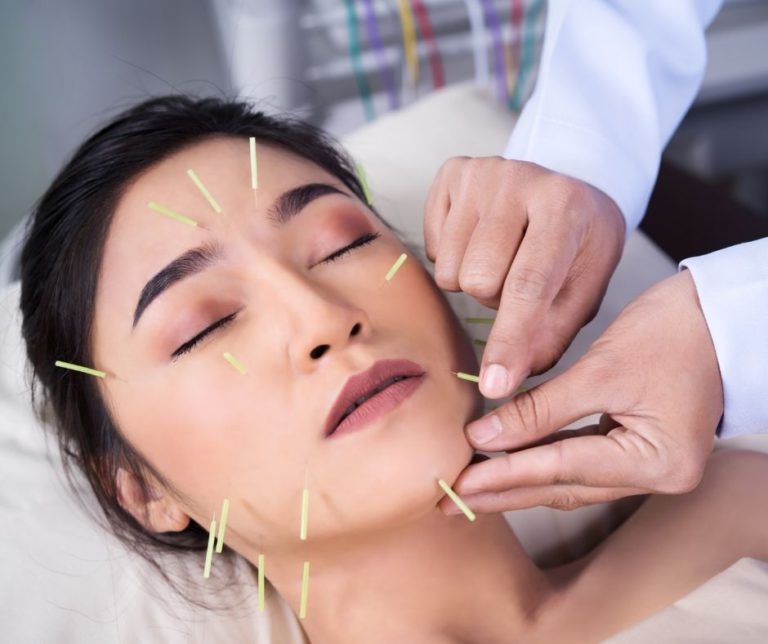 Cosmetic Acupuncture: Key Drawbacks to Consider